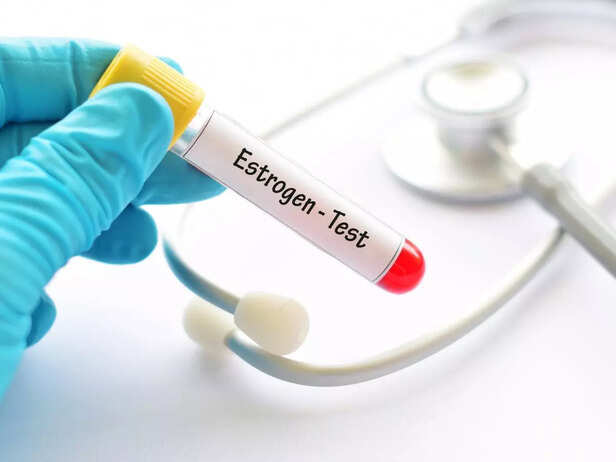 ESTROGEN TEST