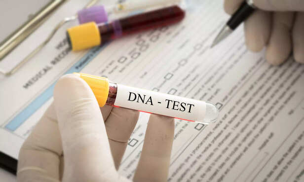 Scientist analyzing DNA result for check genetics and forensics science.