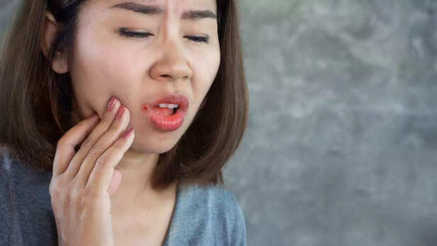 Addressing Dry Mouth